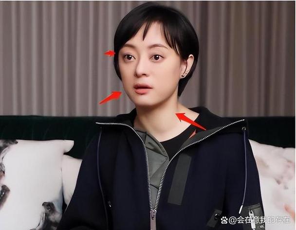 新澳门彩最快开奖记录和孙俪唇下痣没了与孙俪嘴唇的痣