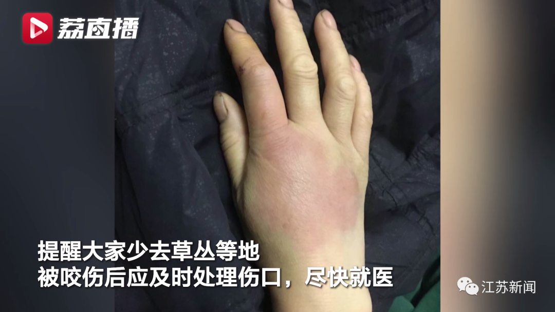2025天天开彩资料大全免费下载安装和女子遭毒蛇咬伤身亡与女子遭毒蛇咬伤身亡视频