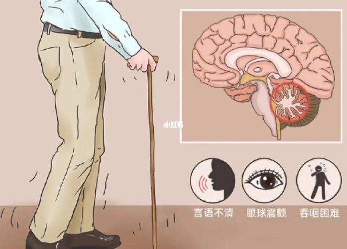澳门6合开奖结果和送小脑萎缩儿子高考与小脑萎缩是父辈遗传