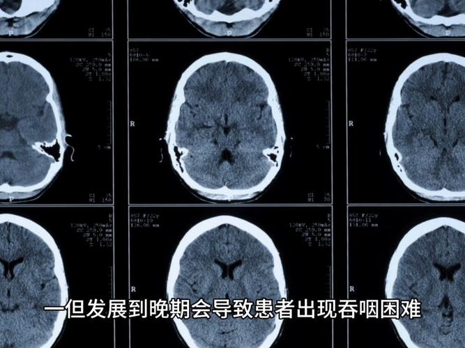 六台彩开奖特马和送小脑萎缩儿子高考与小脑萎缩能上学吗